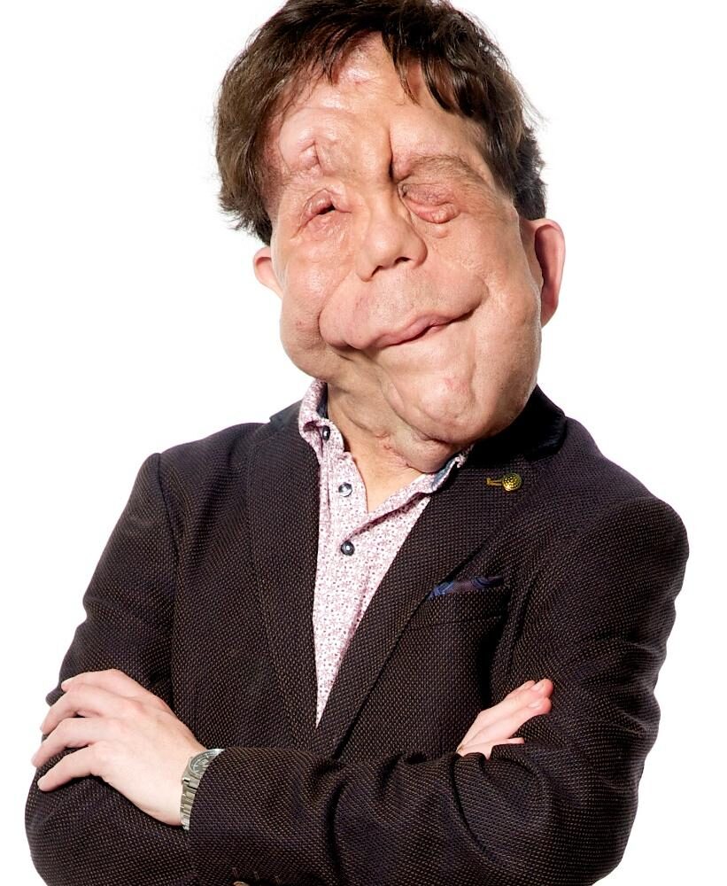 Adam Pearson